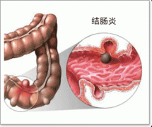 福州肛肠医院