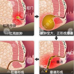 福州肛肠医院