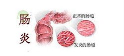 福州肛肠医院 福州医博肛肠医院 福州看痔疮的医院 福州肛瘘医院 福州肛裂医院 福州肠炎医院