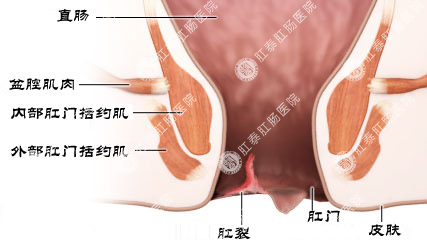 福州肛肠医院 福州医博肛肠医院 福州看痔疮的医院 福州肛瘘医院 福州肛裂医院 福州肠炎医院