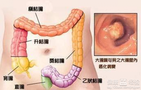 福州肛肠医院