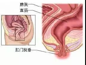 福州肛肠医院