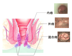 福州肛肠医院