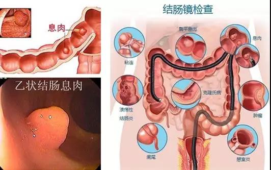 福州肛肠医院