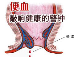 福州肛肠医院