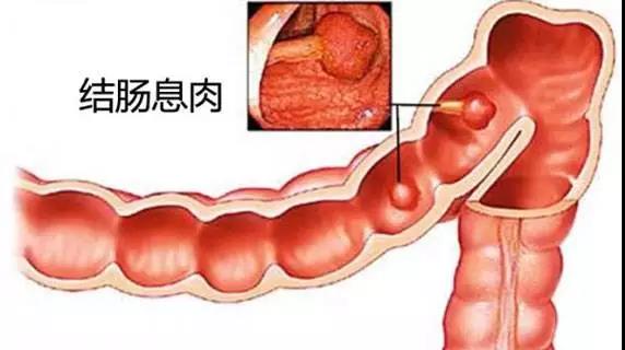 福州肛肠医院