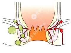 福州肛肠医院