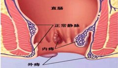 福州肛肠医院