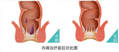 福州肛肠医院