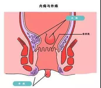 福州肛肠医院