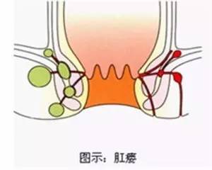 福州肛肠医院