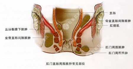 福州肛肠医院