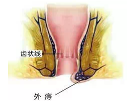 福州肛肠医院