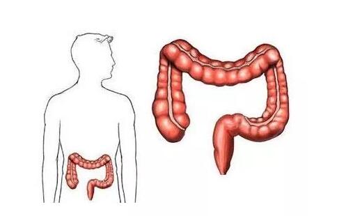 为什么肠癌一发现就是晚期？难道身体没有提前发出预警信号吗？