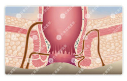 肛门湿疹是怎么回事？