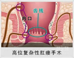 福州肛肠医院