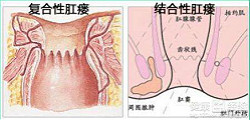 福州肛肠医院