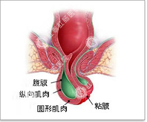 福州肛肠医院