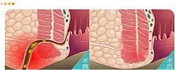 福州肛肠医院