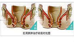 福州肛肠医院