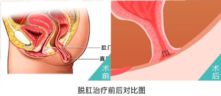 福州肛肠医院