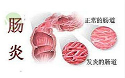 直肠炎有哪些危害？怎么治疗慢性直肠炎？