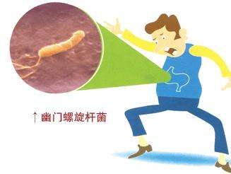 福清市医院可以做幽门螺杆菌检查吗