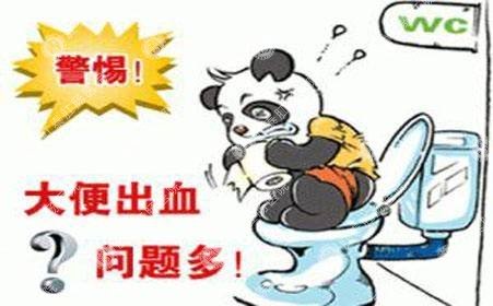 顺产痔疮脱出怎么办？福州医博肛肠医院医师