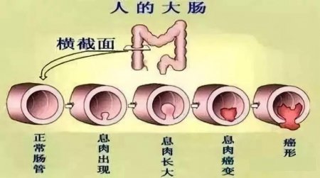 福州做肠镜检查到哪家肛肠医院好