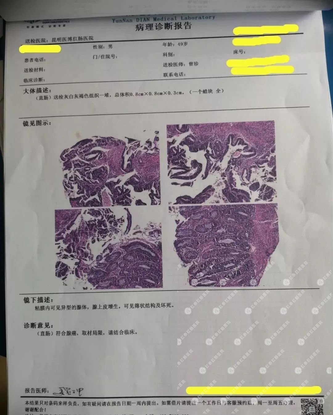 看完这三个故事,35岁以上的你还拒绝做胃肠镜吗？