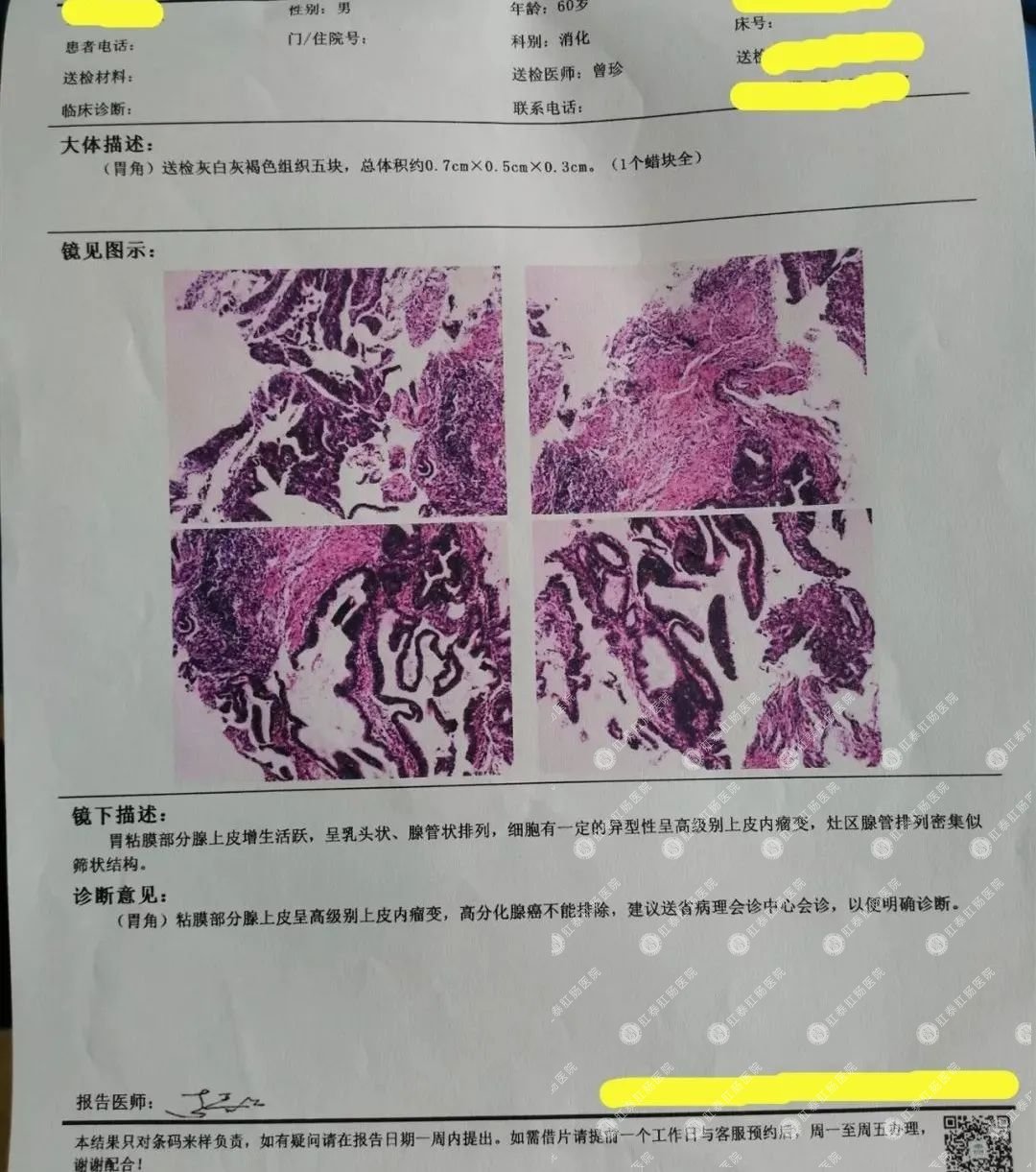 看完这三个故事,35岁以上的你还拒绝做胃肠镜吗？