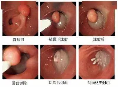 福州胃肠医院排名哪一个专业些