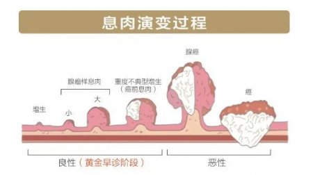 胃病5年,吃药5年,为什么胃病没好反而加重了？