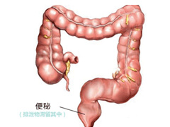 福州肛肠医院 福州医博肛肠医院 福州看痔疮的医院 福州肛瘘医院 福州肛裂医院 福州肠炎医院