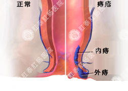 福州肛肠医院