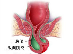 福州肛肠医院 福州医博肛肠医院 福州看痔疮的医院 福州肛瘘医院 福州肛裂医院 福州肠炎医院