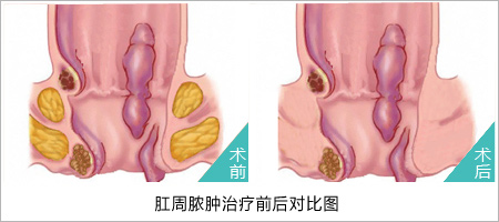 福州肛肠医院