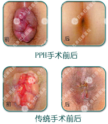 福州肛肠医院