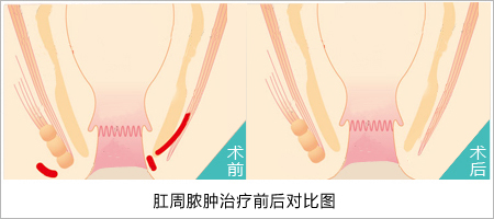 福州肛肠医院