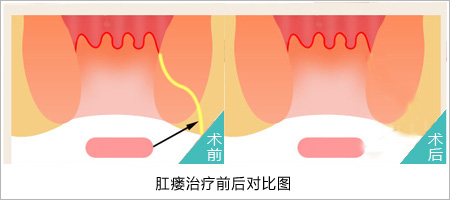 福州肛肠医院