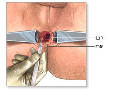 福州肛肠医院