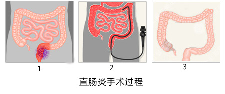 福州肛肠医院