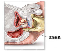 福州肛肠医院 福州医博肛肠医院 福州看痔疮的医院 福州肛瘘医院 福州肛裂医院 福州肠炎医院