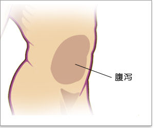 福州肛肠医院 福州医博肛肠医院 福州看痔疮的医院 福州肛瘘医院 福州肛裂医院 福州肠炎医院