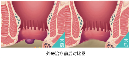 福州肛肠医院