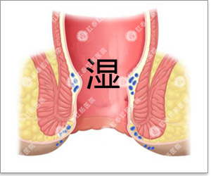 福州肛肠医院 福州医博肛肠医院 福州看痔疮的医院 福州肛瘘医院 福州肛裂医院 福州肠炎医院