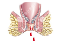 福州肛肠医院
