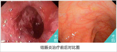 福州肛肠医院