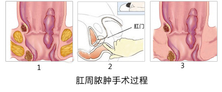 福州肛肠医院