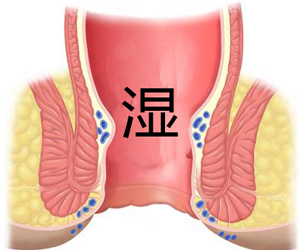 福州肛肠医院 福州医博肛肠医院 福州看痔疮的医院 福州肛瘘医院 福州肛裂医院 福州肠炎医院